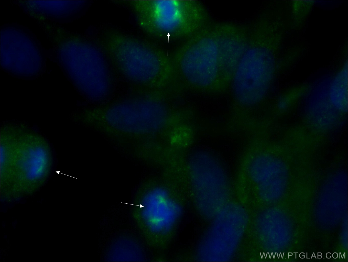 IF Staining of MDCK using 22271-1-AP