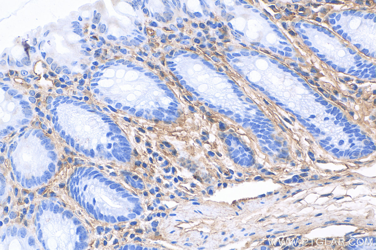 IHC staining of mouse colon using 27794-1-AP IHC staining of mouse colon using 27794-1-AP