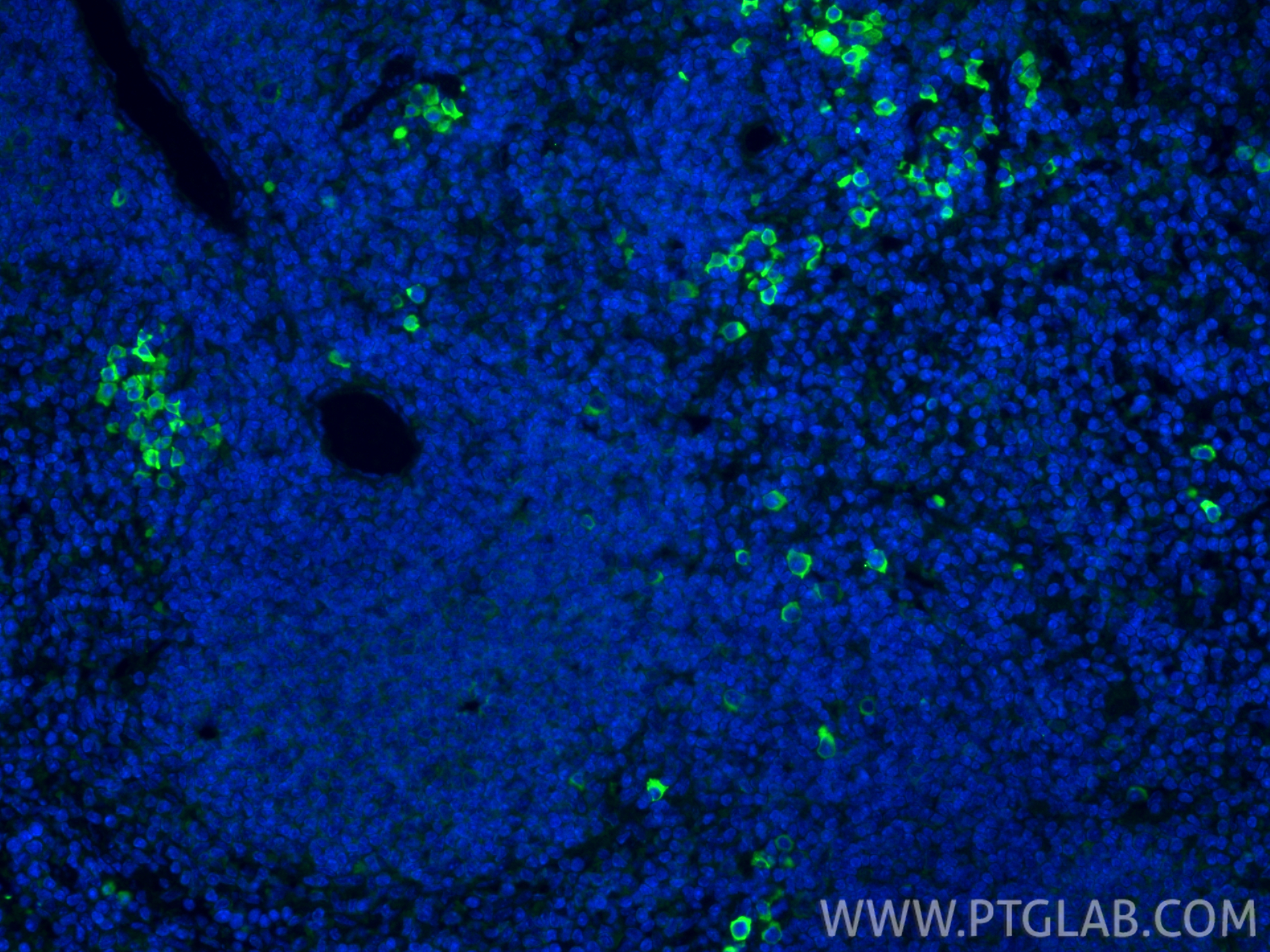 IF Staining of mouse spleen using 66491-1-Ig IF Staining of mouse spleen using 66491-1-Ig