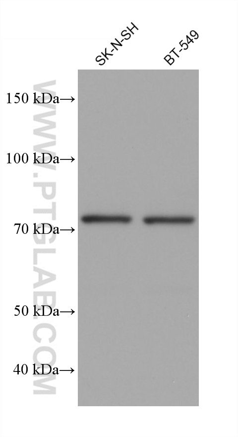 WB analysis using 66491-1-Ig