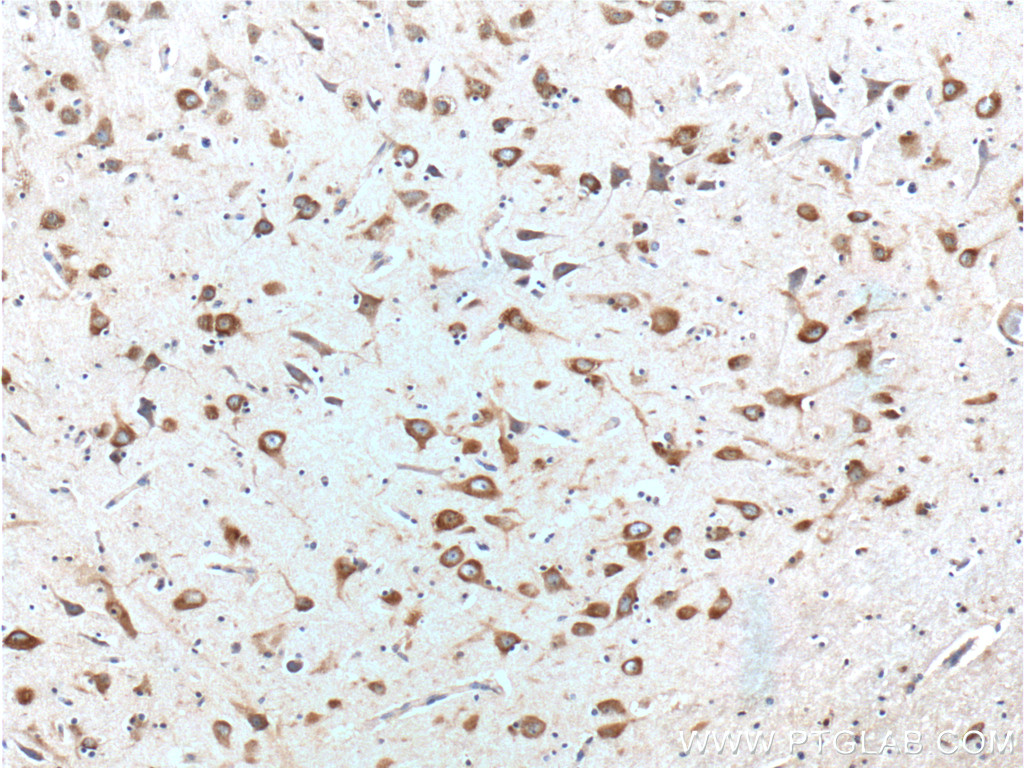 IHC staining of human brain using 66317-1-Ig (same clone as 66317-1-PBS)