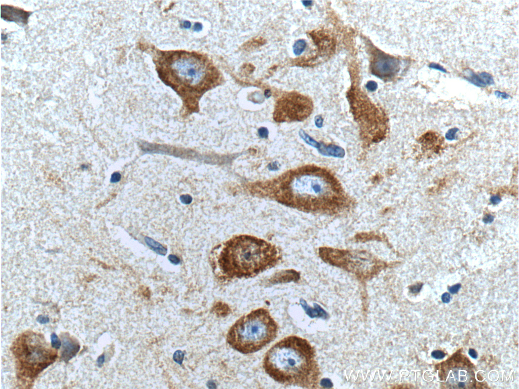 IHC staining of human brain using 66317-1-Ig (same clone as 66317-1-PBS)