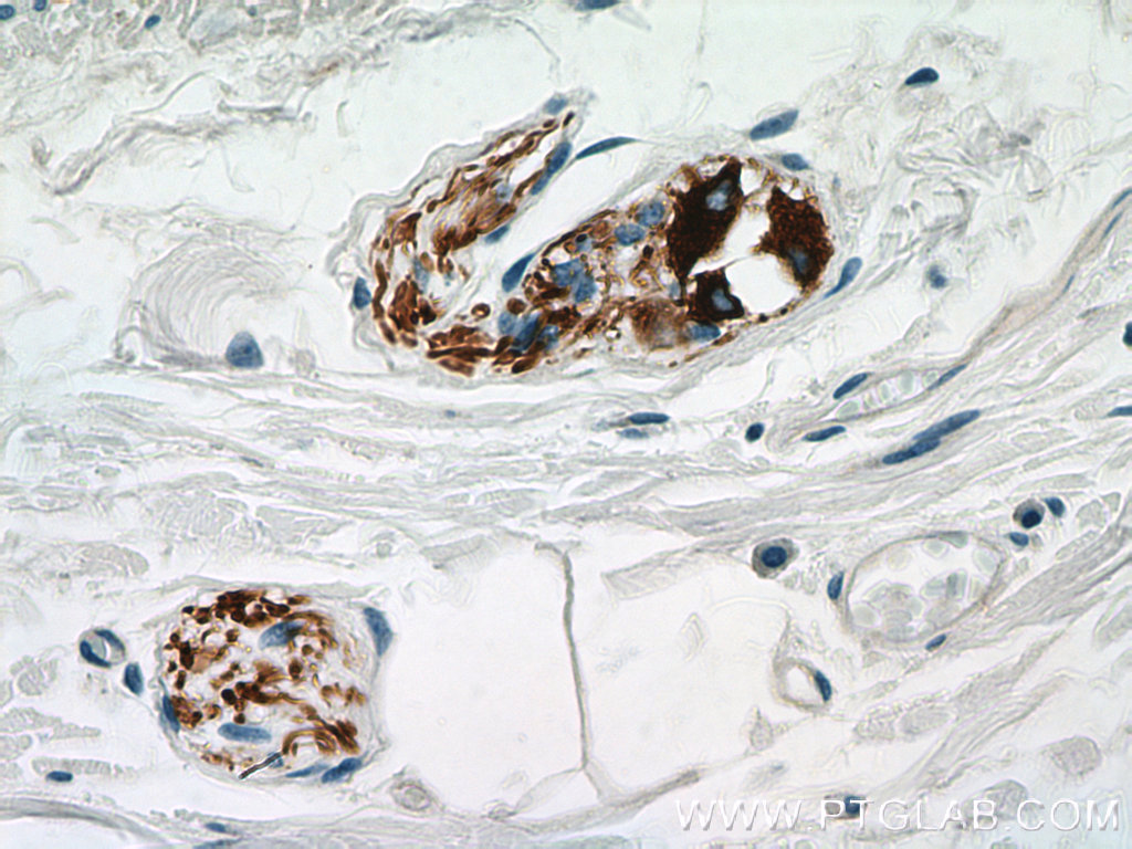 IHC staining of human colon using 66317-1-Ig (same clone as 66317-1-PBS)