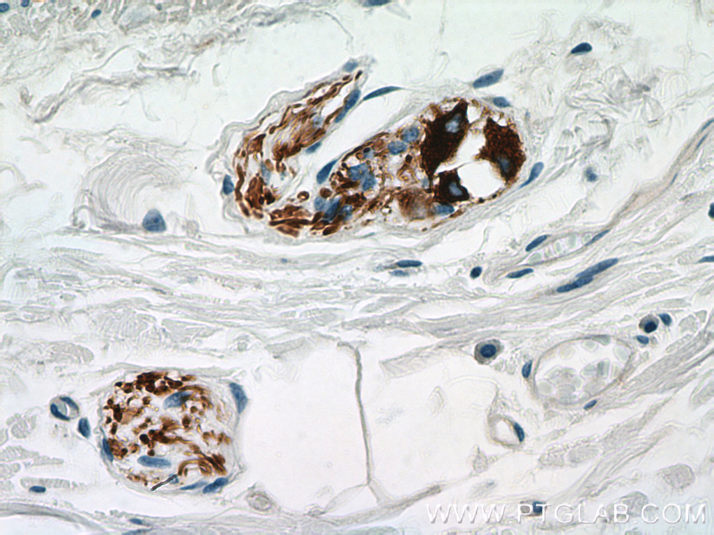 IHC staining of human colon using 66317-1-Ig