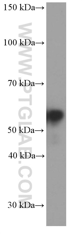 WB analysis of rat brain using 66317-1-Ig (same clone as 66317-1-PBS)