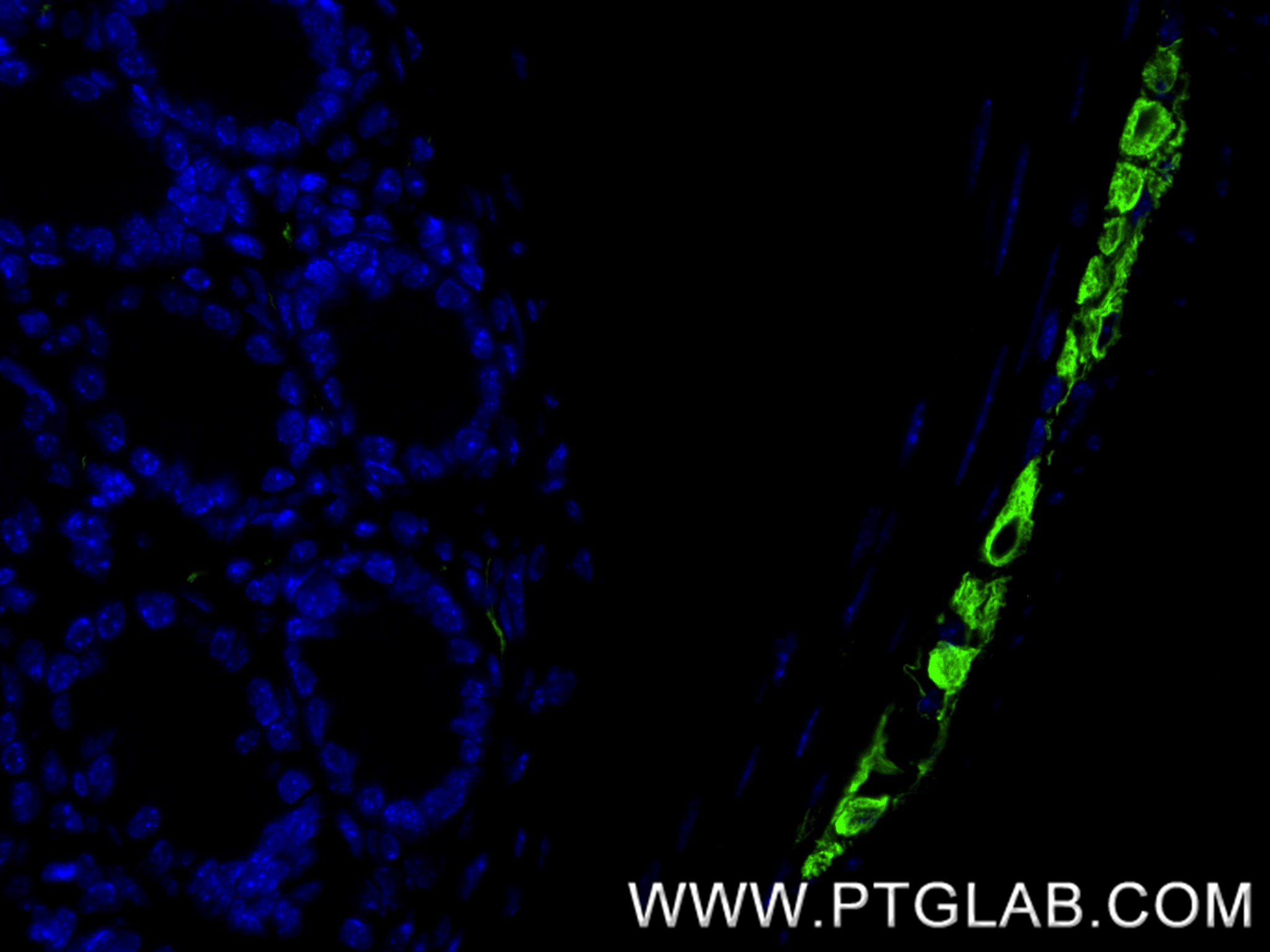 IF Staining of mouse colon using 86057-1-RR