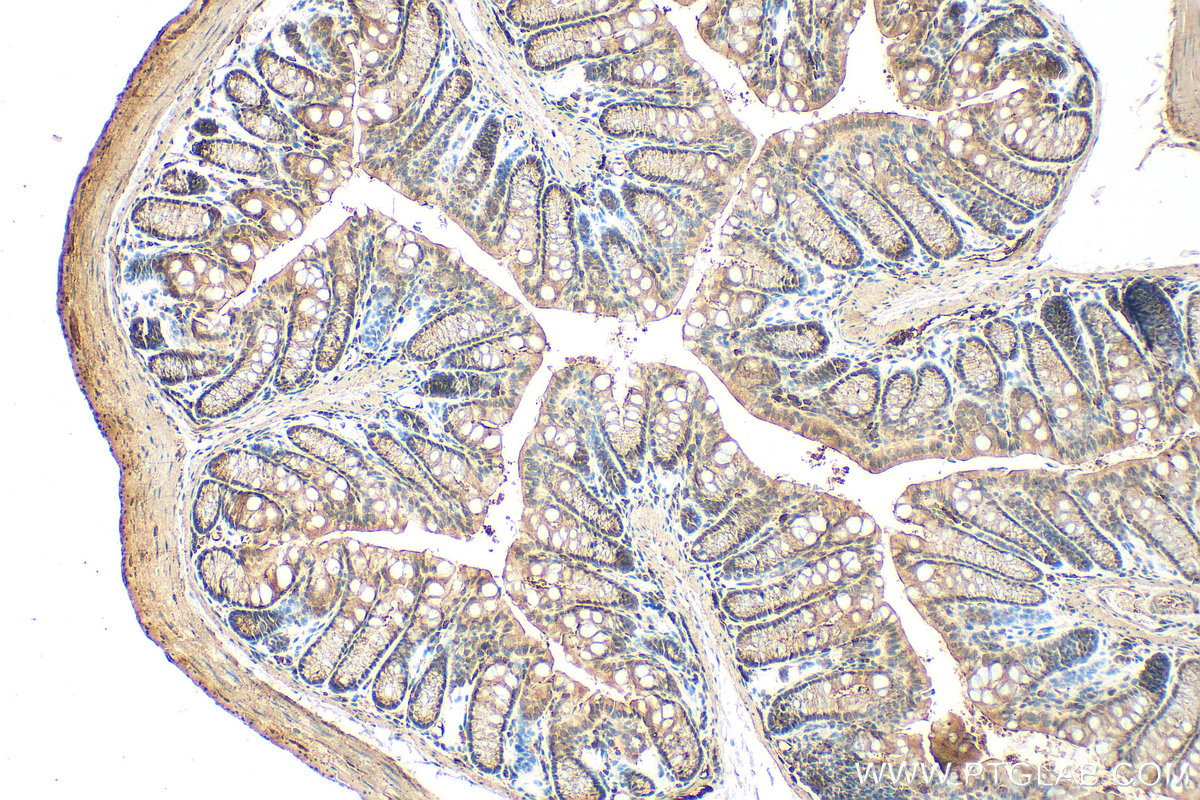 IHC staining of mouse colon using 30437-1-AP