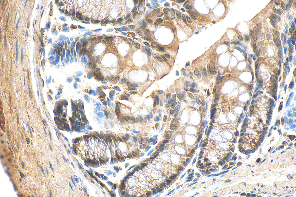 IHC staining of mouse colon using 30437-1-AP
