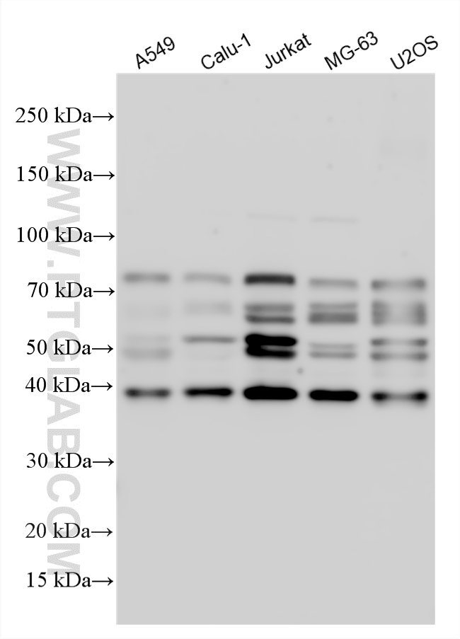 WB analysis using 30437-1-AP