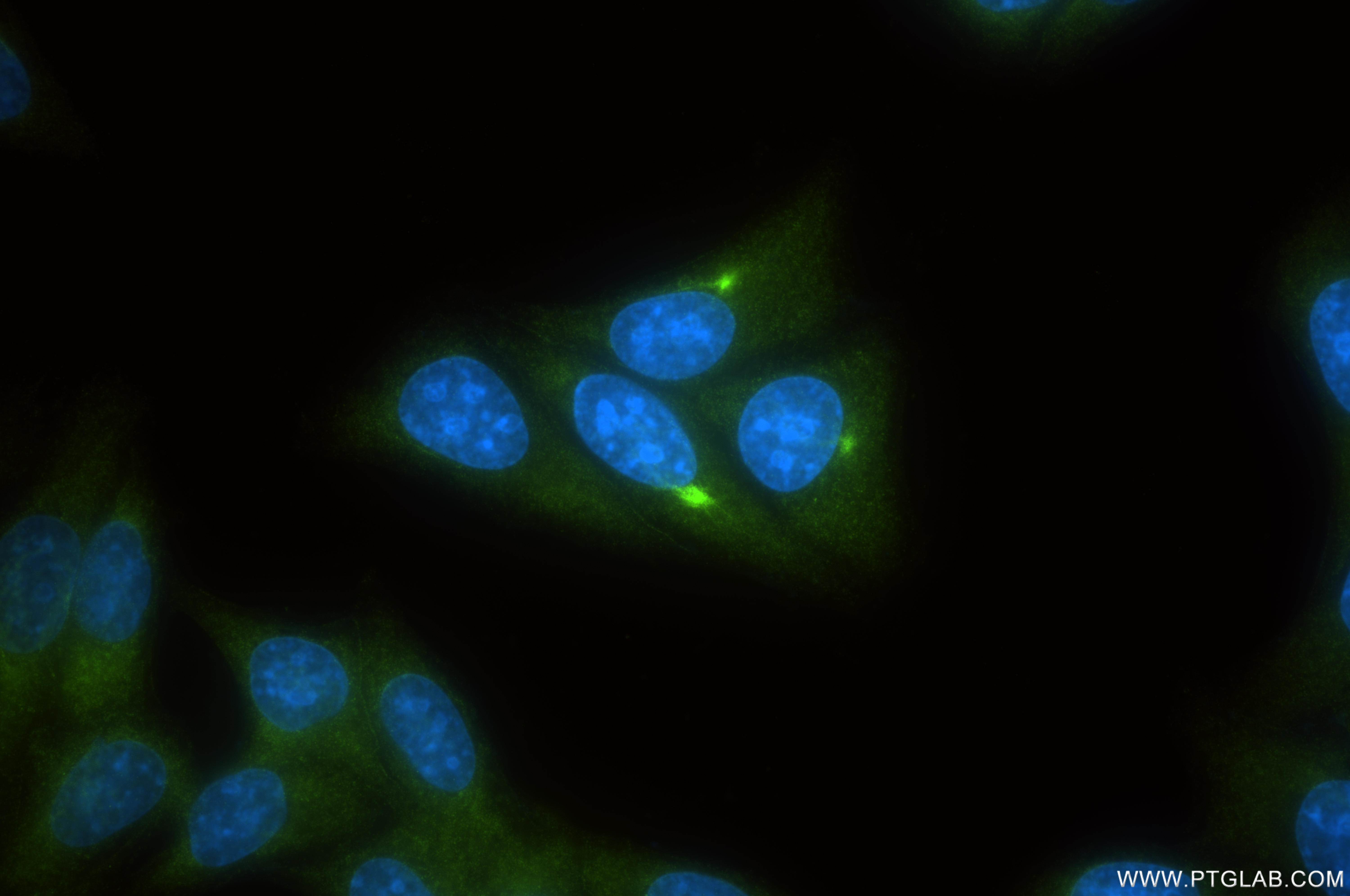 IF Staining of HepG2 using 86599-1-RR IF Staining of HepG2 using 86599-1-RR