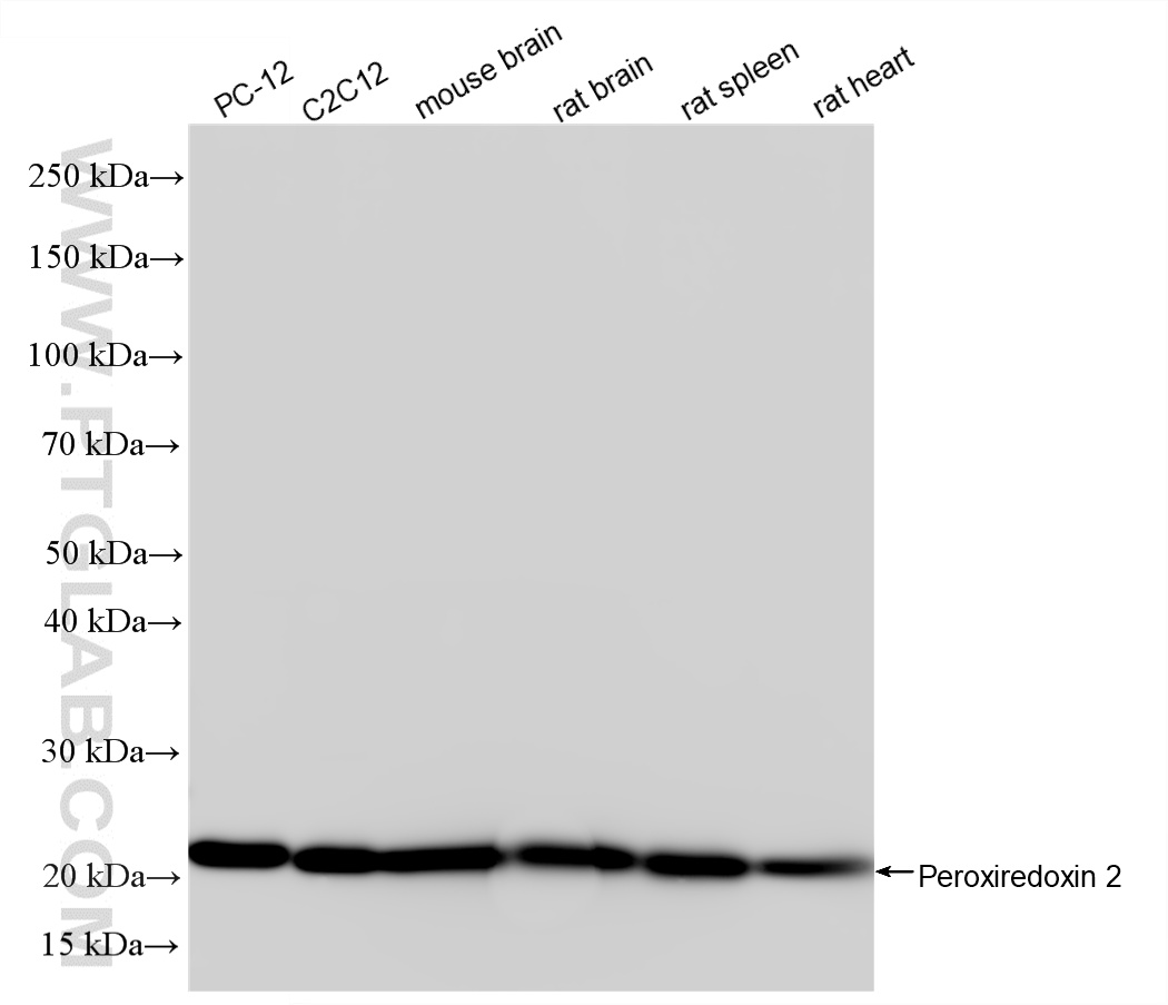 WB analysis using 86599-1-RR WB analysis using 86599-1-RR