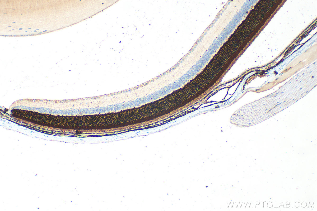 IHC staining of mouse eye using 33132-1-AP