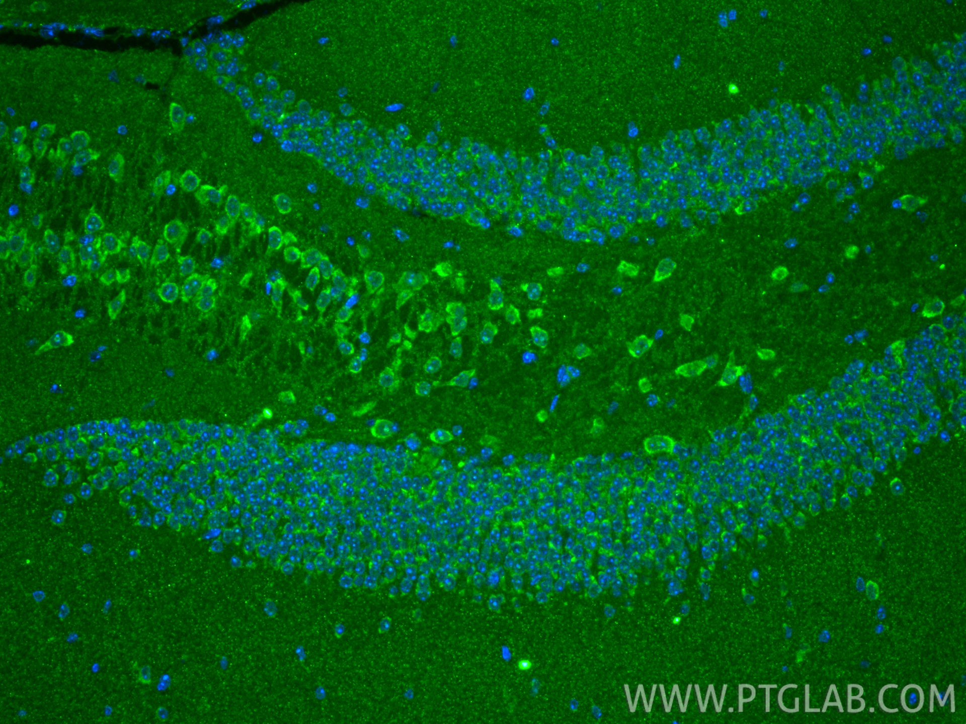IF Staining of mouse brain using 29119-1-AP IF Staining of mouse brain using 29119-1-AP