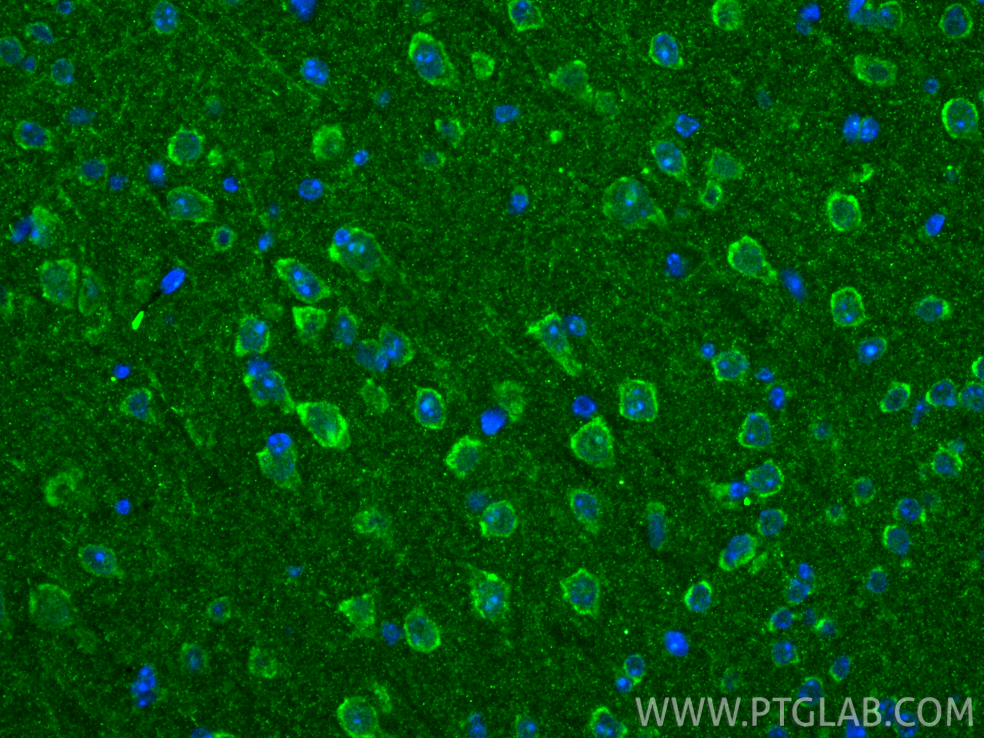 IF Staining of mouse brain using 29119-1-AP IF Staining of mouse brain using 29119-1-AP