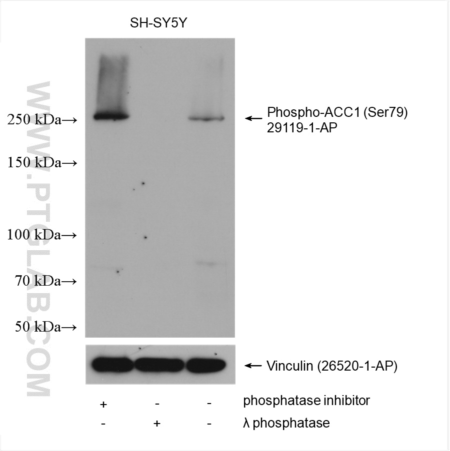 WB analysis using 29119-1-AP