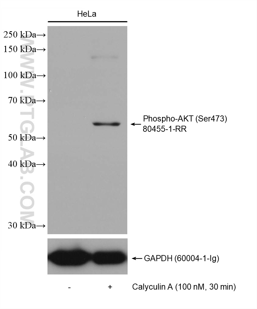 WB analysis of HeLa using 80455-1-RR