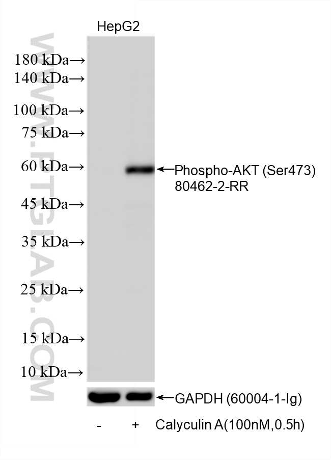WB analysis using 80462-2-RR WB analysis using 80462-2-RR