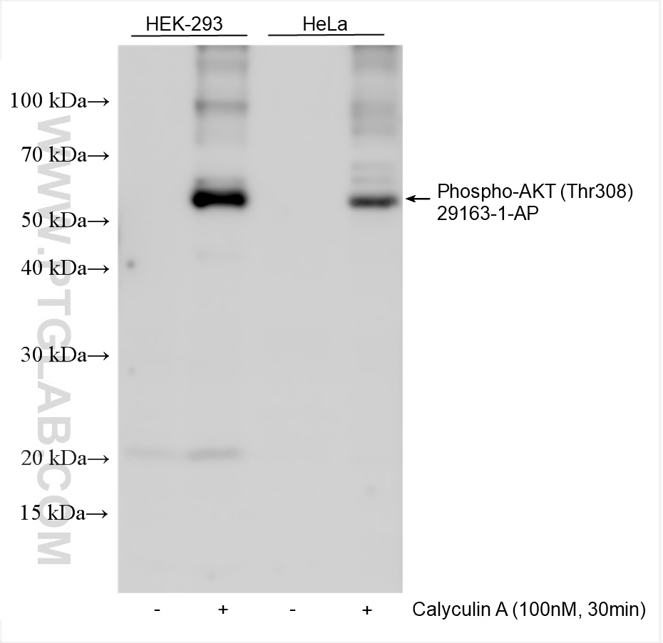 WB analysis using 29163-1-AP