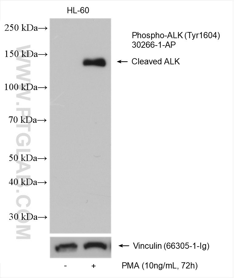 Phospho-ALK (Tyr1604)
