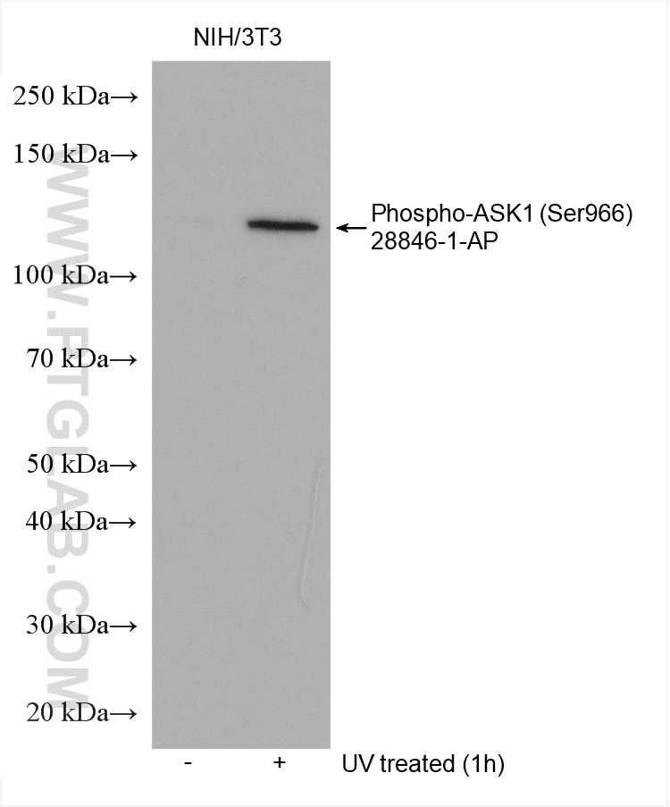 Phospho-ASK1 (Ser966)