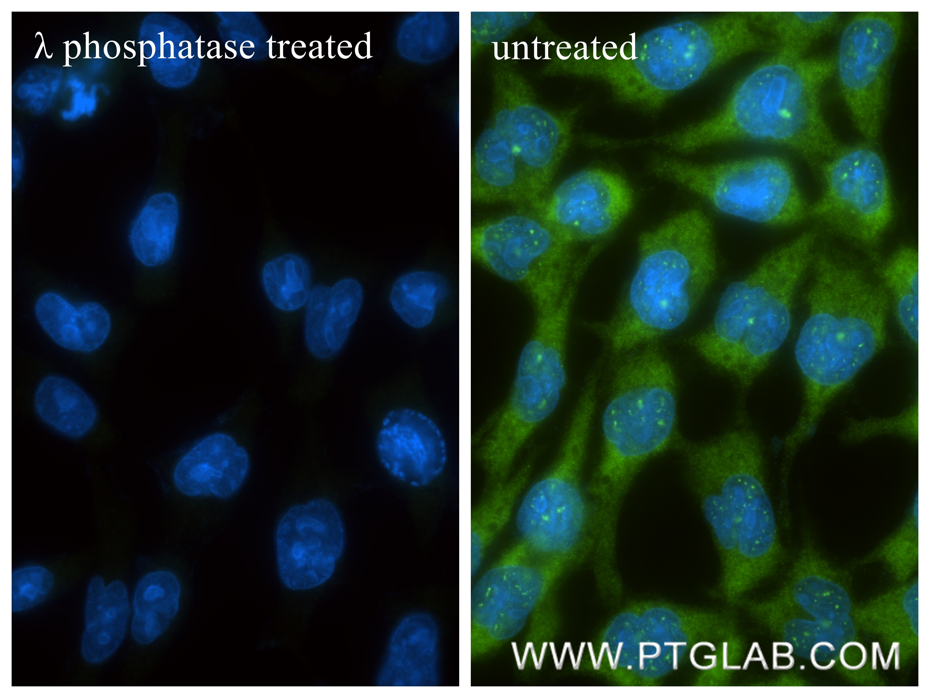 IF Staining of COS-7 using 80142-8-RR IF Staining of COS-7 using 80142-8-RR