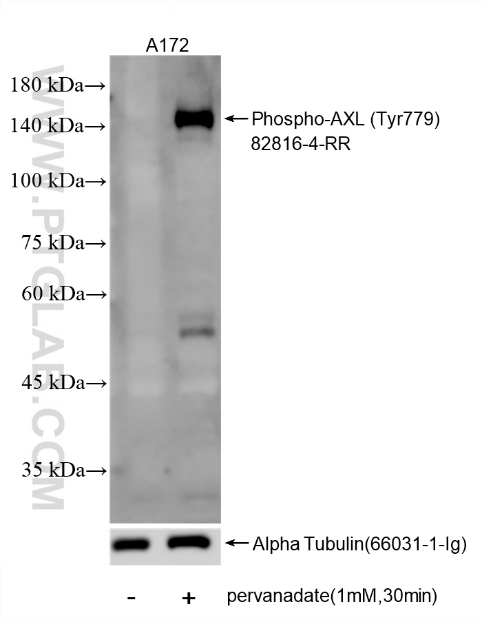 WB analysis of A172 using 82816-4-RR