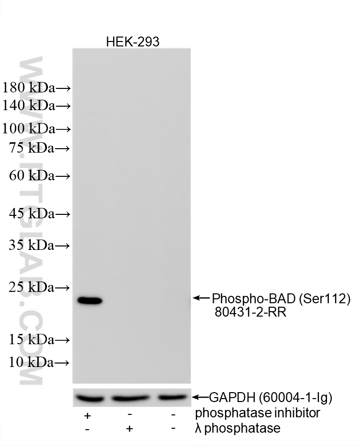 Non-treated HEK-293 cells, phosphatase inhibitor treated HEK-293 cells and λ phosphatase treated HEK-293 cells were subjected to SDS PAGE followed by western blot with <a class='green' href='/productredirect?CatalogNo=80431-2-RR' target='_blank'>80431-2-RR</a> (Phospho-BAD (Ser112) antibody) at dilution of 1:1000 incubated at room temperature for 1.5 hours. The membrane was stripped and re-blotted with GAPDH (<a class='green' href='/productredirect?CatalogNo=60004-1-Ig' target='_blank'>60004-1-Ig</a>) antibody as a loading control. This data was developed using the same antibody clone with 80431-2-PBS in a different storage buffer formulation. WB analysis of HEK-293 using 80431-2-RR (same clone as 80431-2-PBS)