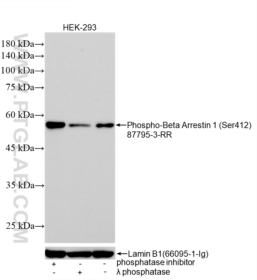WB analysis using 87795-3-RR (same clone as 87795-3-PBS) WB analysis using 87795-3-RR (same clone as 87795-3-PBS)