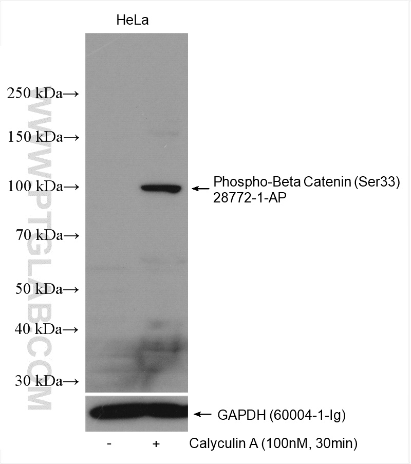 WB analysis using 28772-1-AP