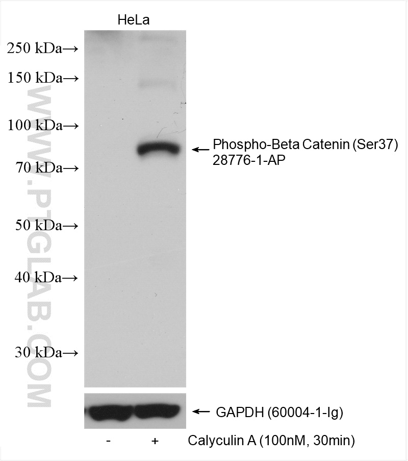 WB analysis using 28776-1-AP