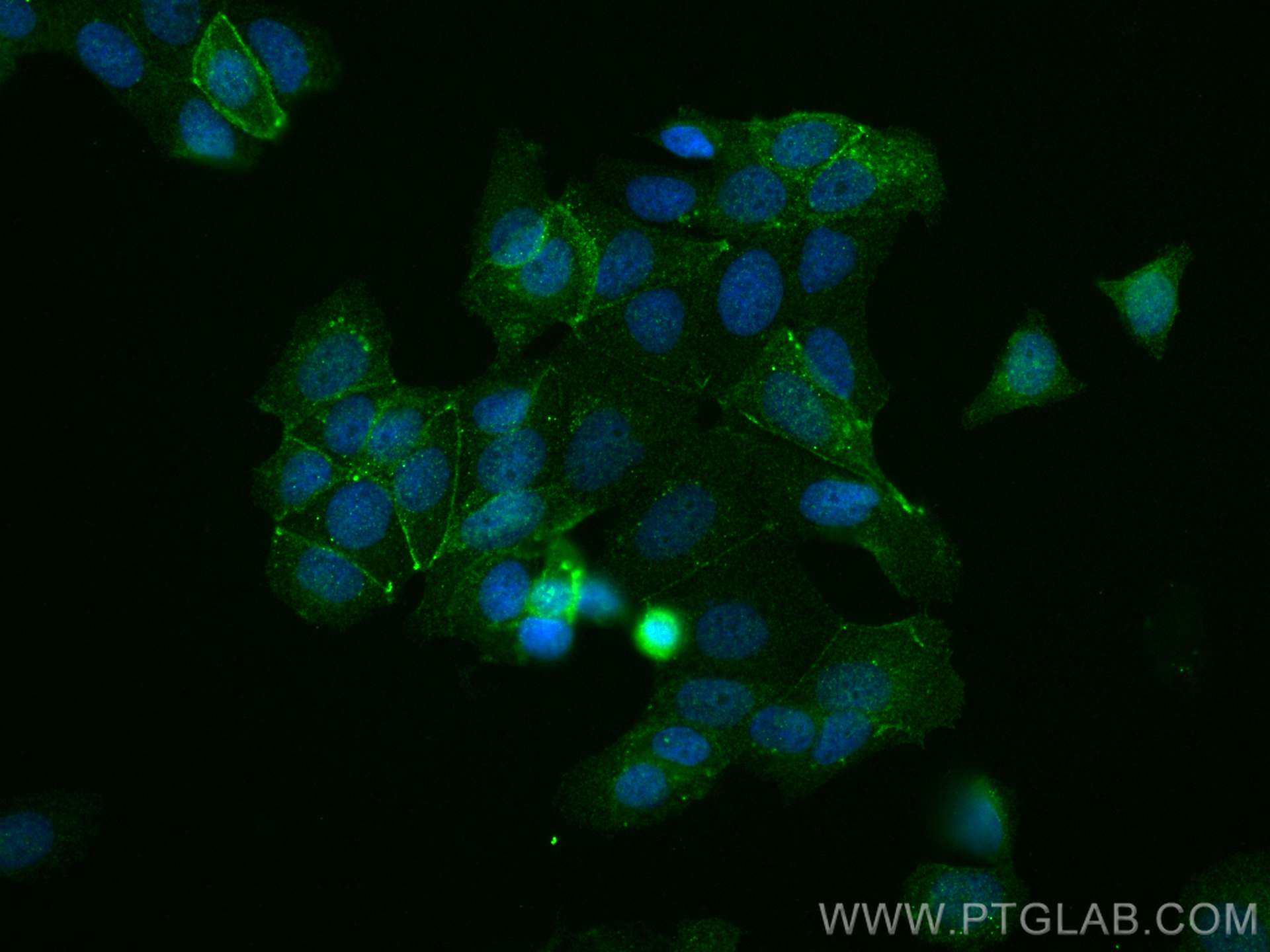 IF Staining of MCF-7 using 28778-1-AP