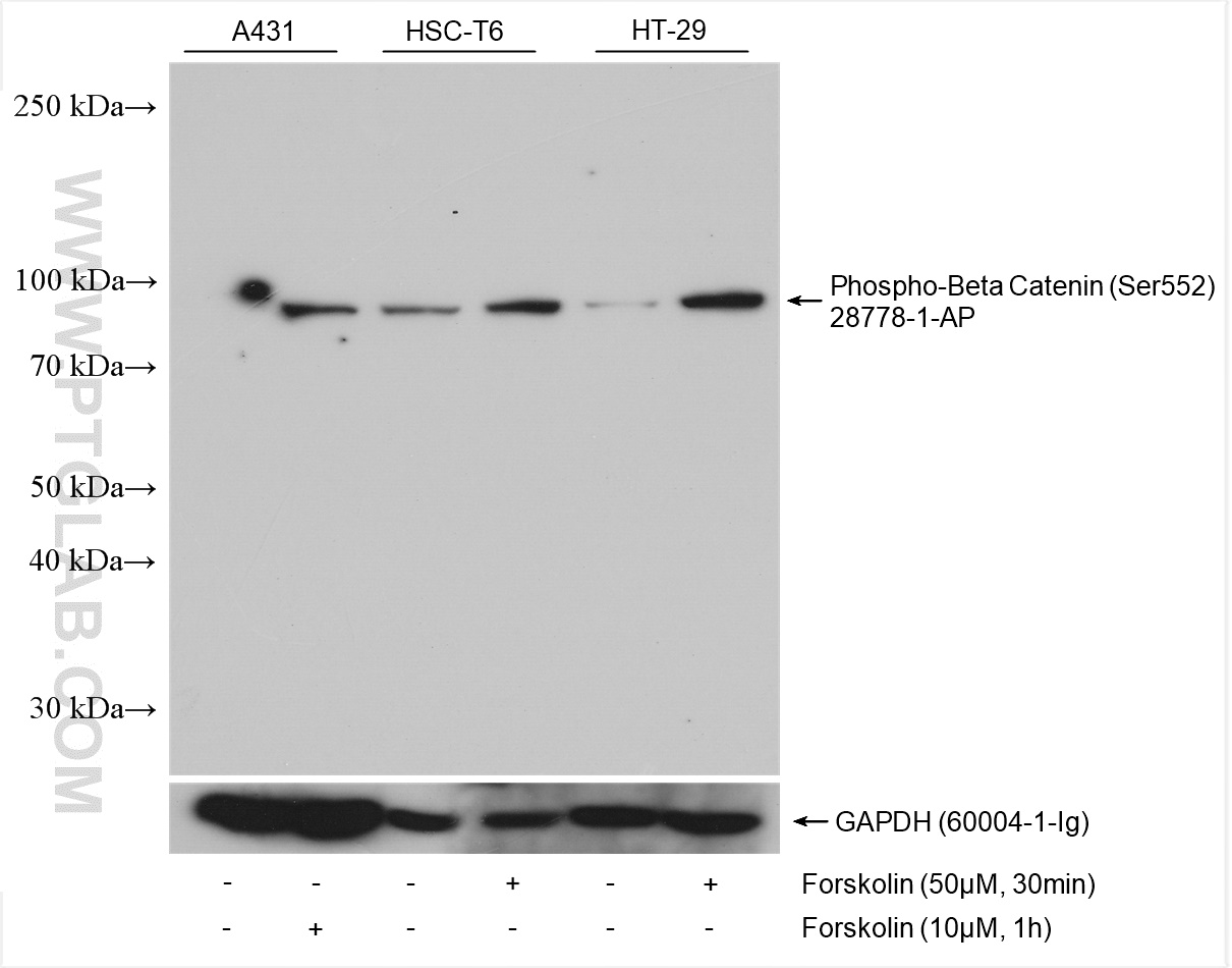 Phospho-Beta Catenin (Ser552)