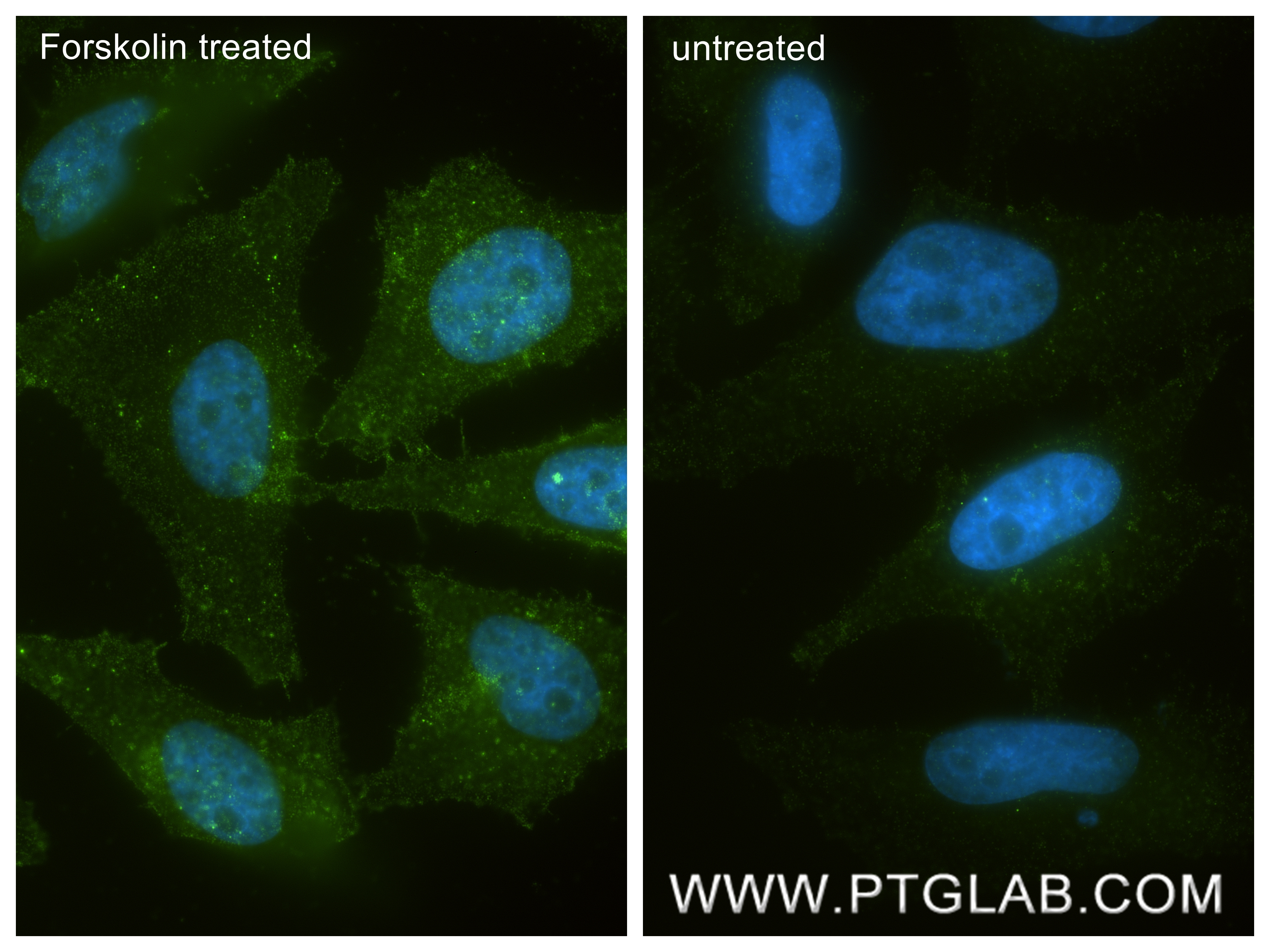 IF Staining of HeLa using 80035-2-RR