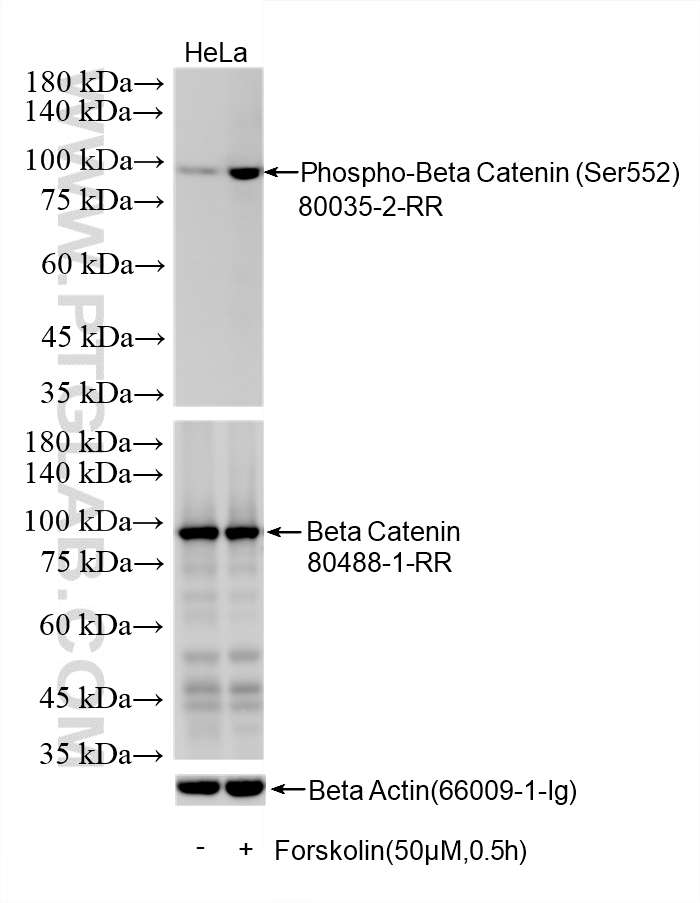 Non-treated HeLa cells and Forskolin treated HeLa cells were subjected to SDS PAGE followed by western blot with 80035-2-RR (Phospho-Beta Catenin (Ser552) antibody) at dilution of 1:5000 incubated at room temperature for 1.5 hours. The membrane was stripped and re-blotted with Beta Catenin (<a class='green' href='/productredirect?CatalogNo=80488-1-RR' target='_blank'>80488-1-RR</a>) antibody as a loading control. WB analysis using 80035-2-RR