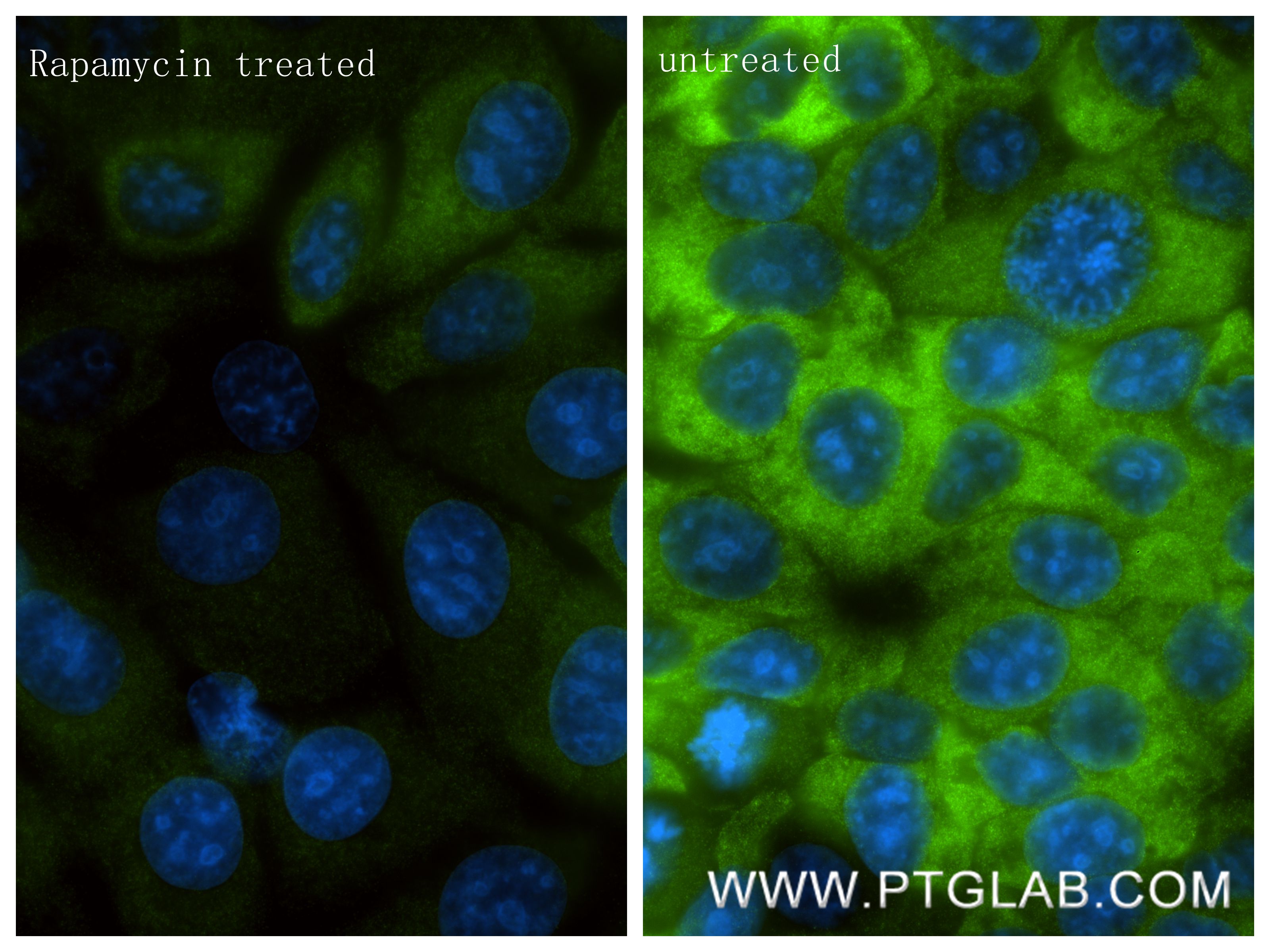 IF Staining of MCF-7 using 87337-2-RR (same clone as 87337-2-PBS) IF Staining of MCF-7 using 87337-2-RR (same clone as 87337-2-PBS)
