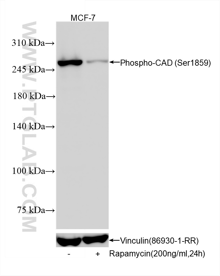 WB analysis using 87337-2-RR (same clone as 87337-2-PBS) WB analysis using 87337-2-RR (same clone as 87337-2-PBS)