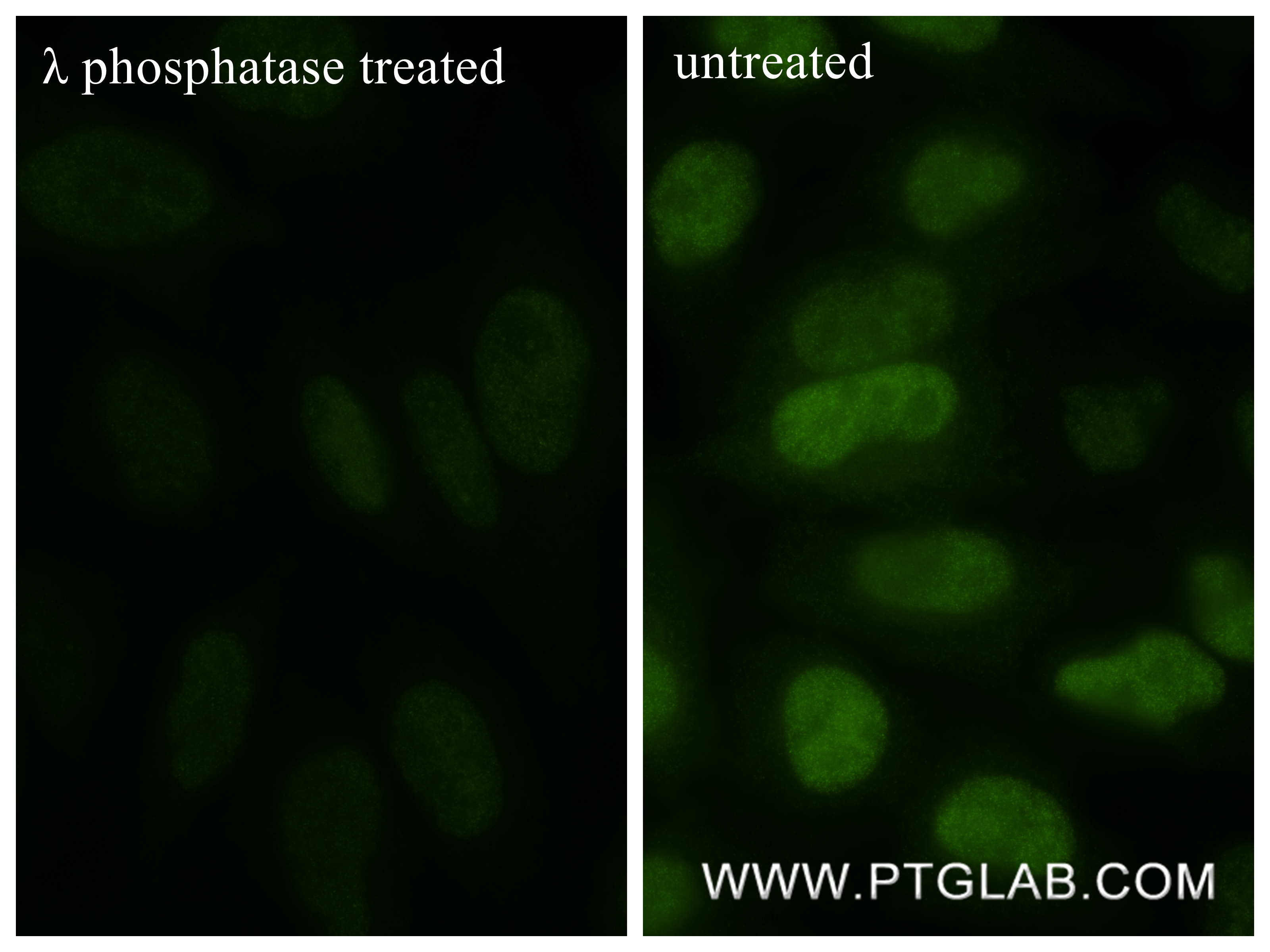 IF Staining of HeLa using 82751-5-RR IF Staining of HeLa using 82751-5-RR