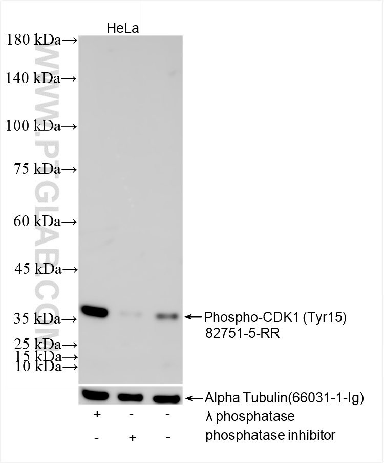 Non-treated HeLa cells, phosphatase inhibitor treated HeLa cells and λ phosphatase treated HeLa cells were subjected to SDS PAGE followed by western blot with 82751-5-RR (Phospho-CDK1 (Tyr15) antibody) at dilution of 1:4000 incubated at room temperature for 1.5 hours. The membrane was stripped and re-blotted with Alpha Tubulin (<a class='green' href='/productredirect?CatalogNo=66031-1-Ig' target='_blank'>66031-1-Ig</a>) antibody as a loading control. WB analysis of HeLa using 82751-5-RR