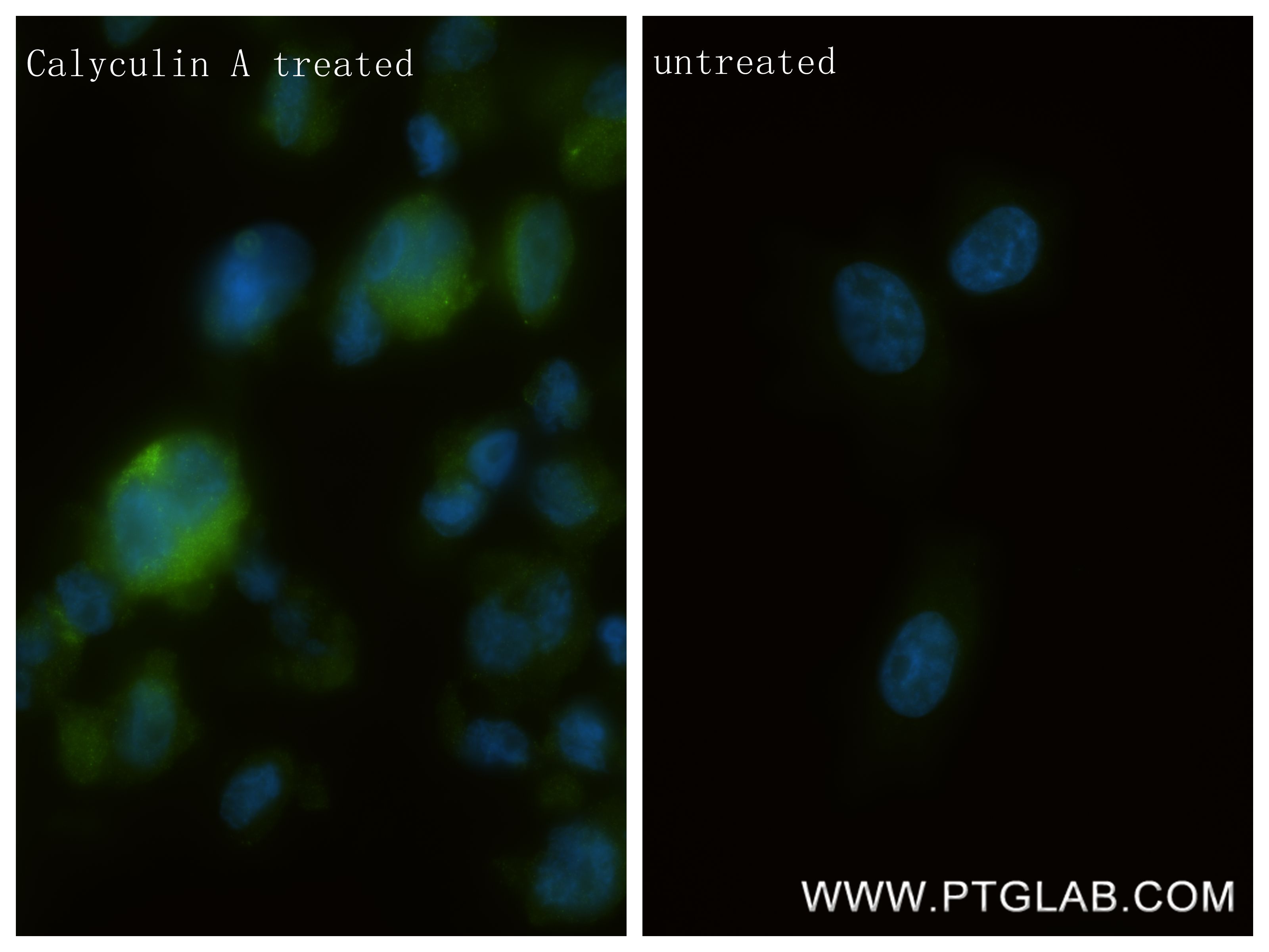 IF Staining of PC-3 using 80067-1-RR
