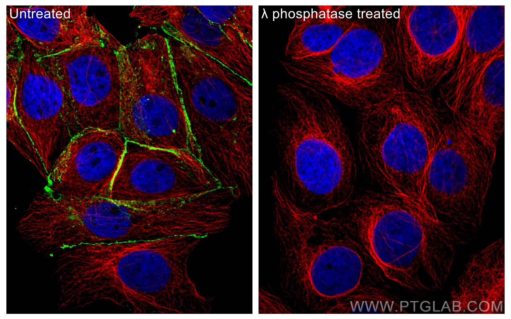 IF Staining of MCF-7 using 80084-1-RR