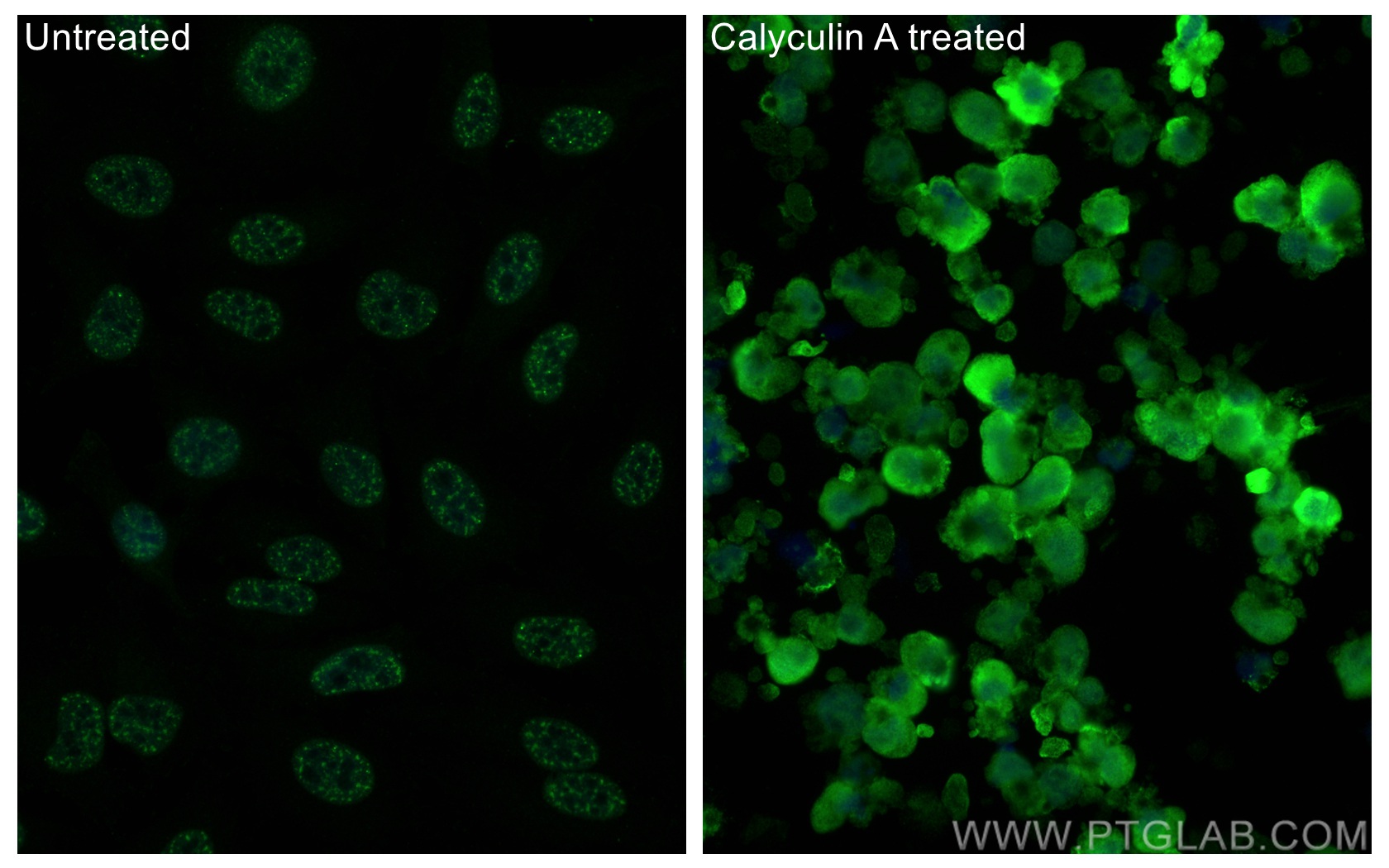 Phospho-Caspase 9 (Ser196)