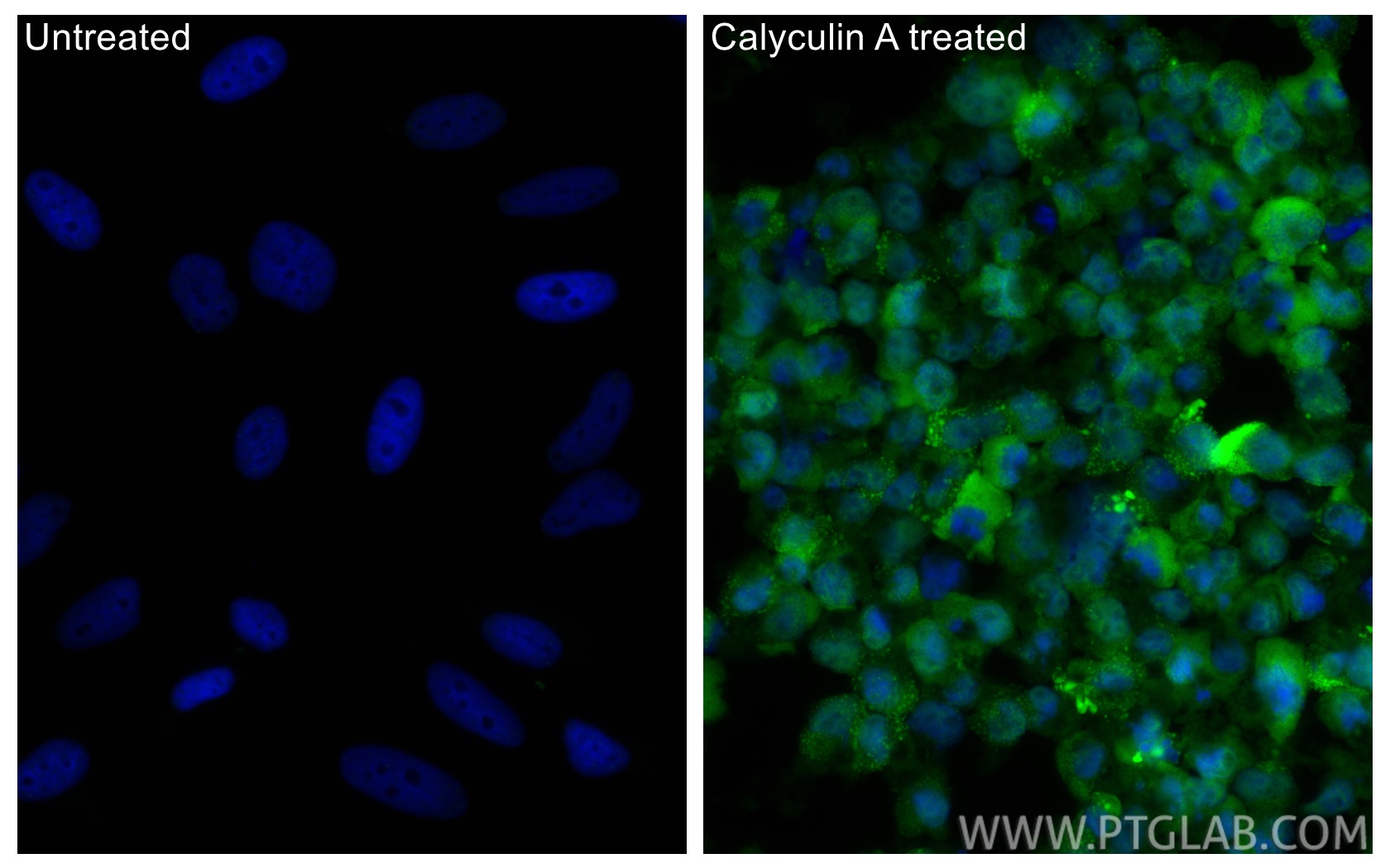 IF Staining of HeLa using CL488-80346 IF Staining of HeLa using CL488-80346