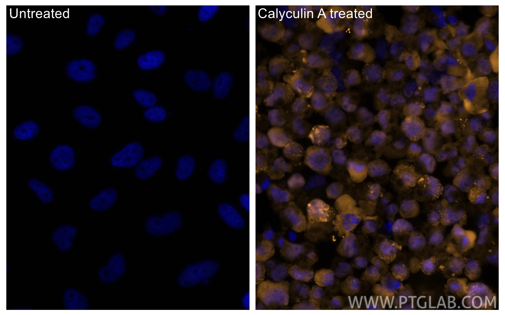 IF Staining of HeLa using CL555-80346