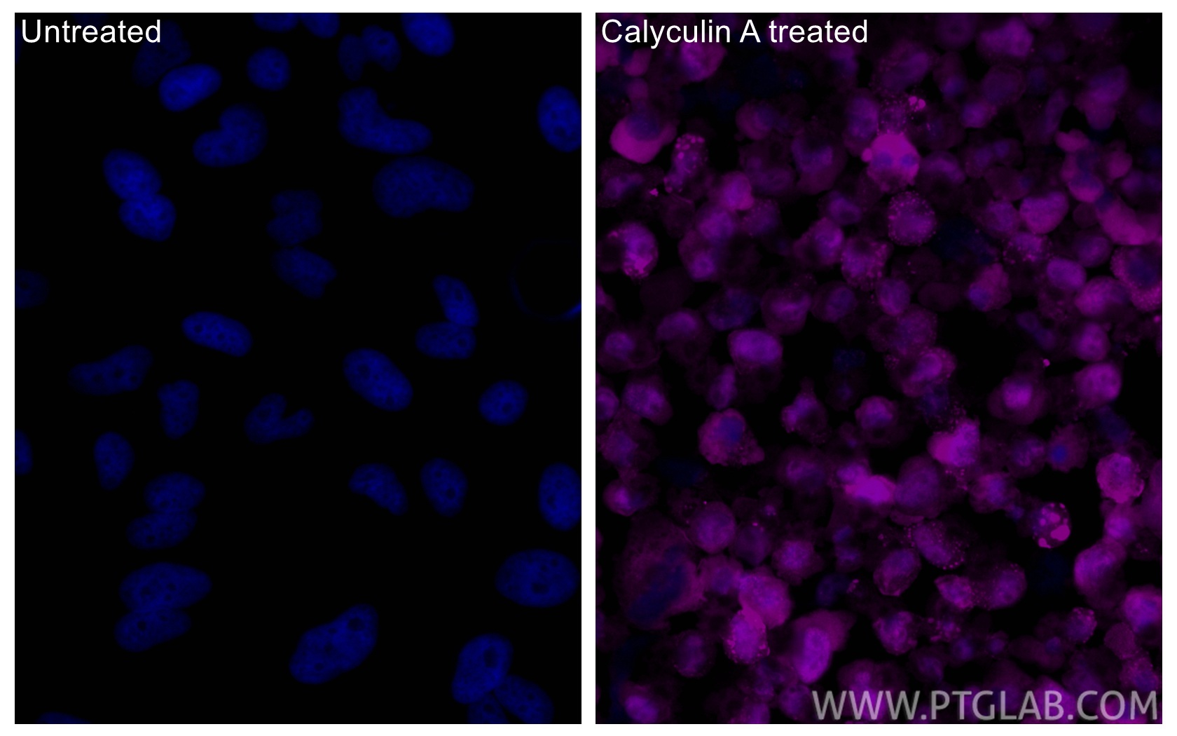 IF Staining of HeLa using CL647-80346 IF Staining of HeLa using CL647-80346