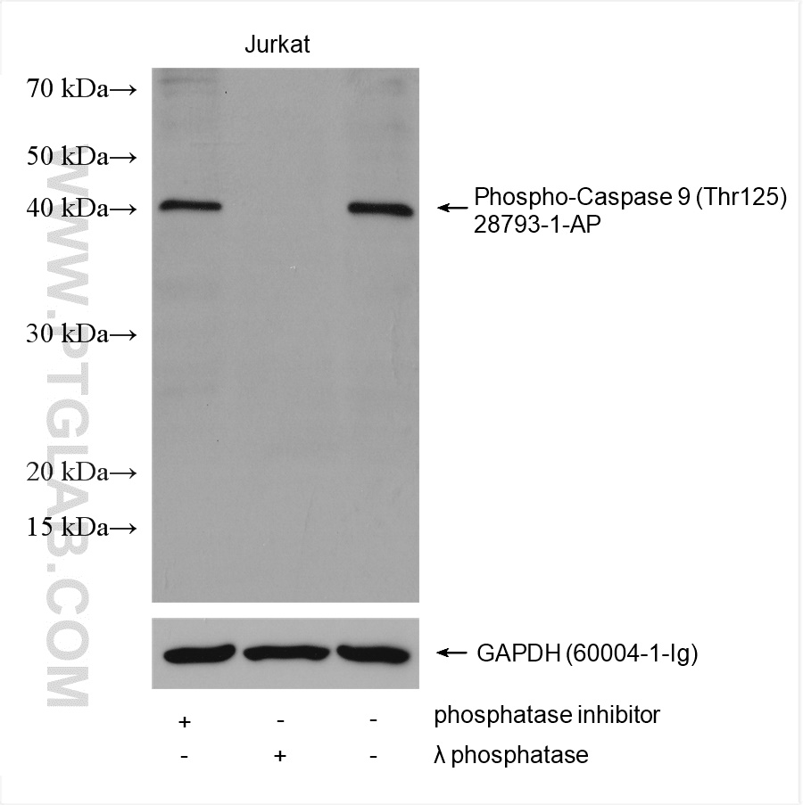 Phospho-Caspase 9 (Thr125)