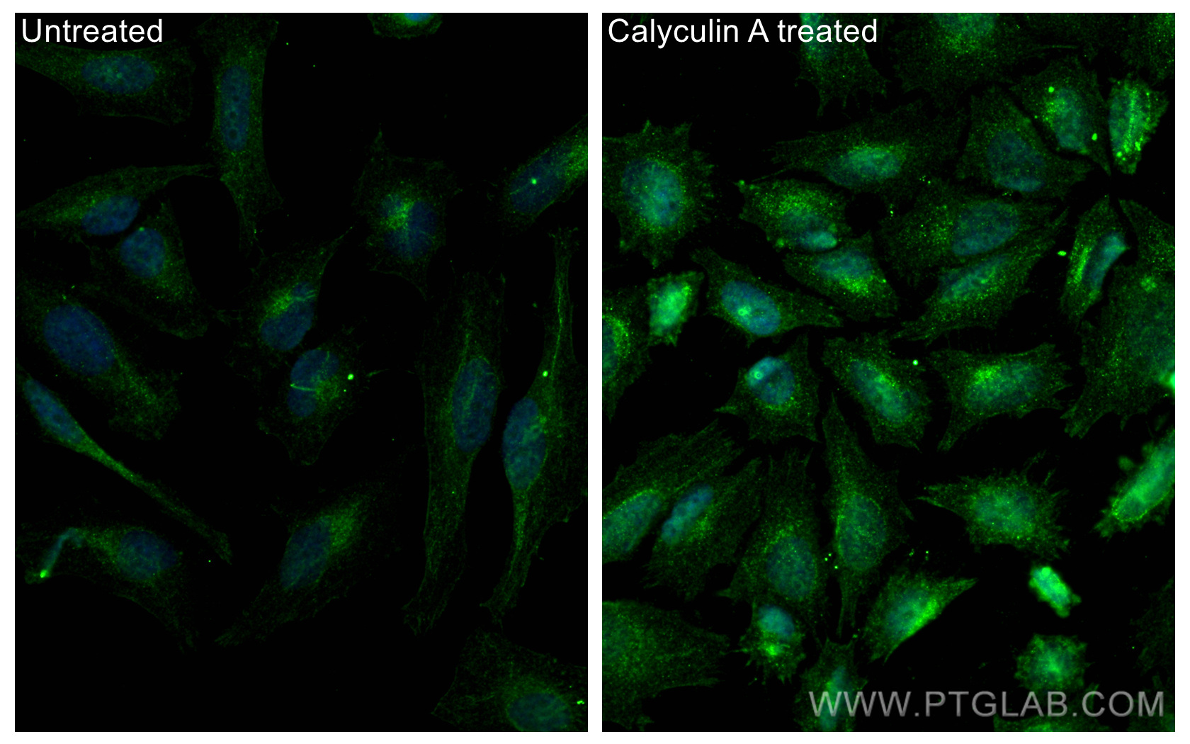 IF Staining of HeLa using 28803-1-AP