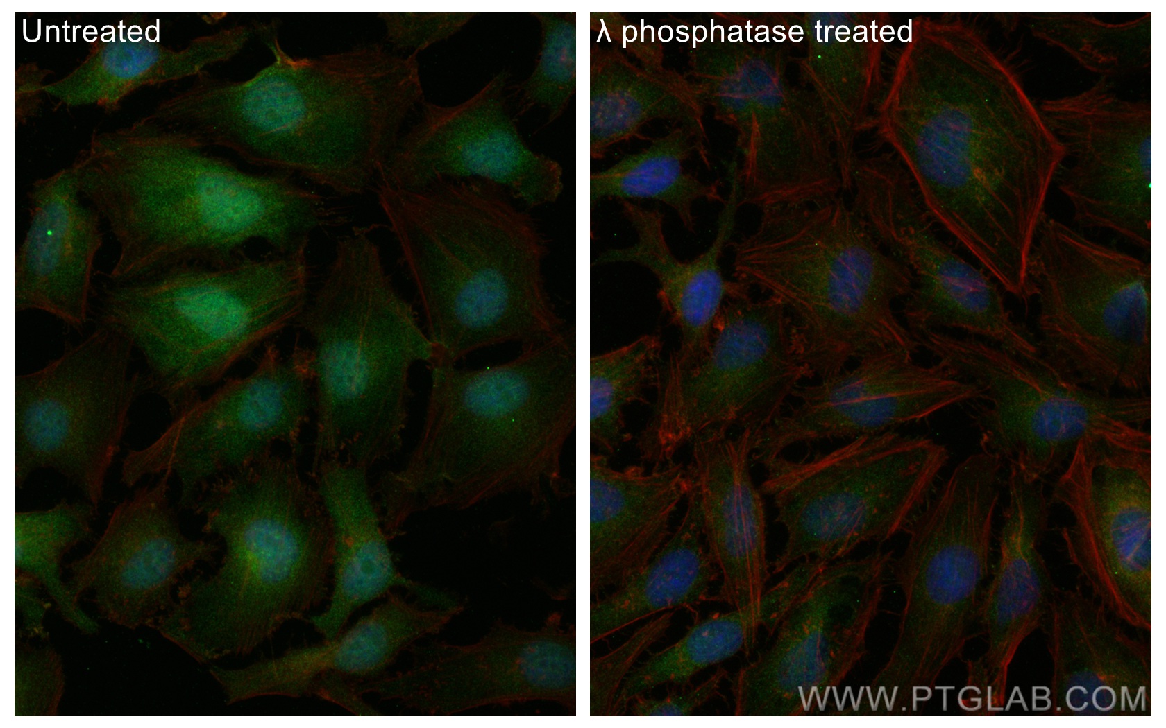 IF Staining of HeLa using 29715-1-AP (same clone as 29715-1-PBS)