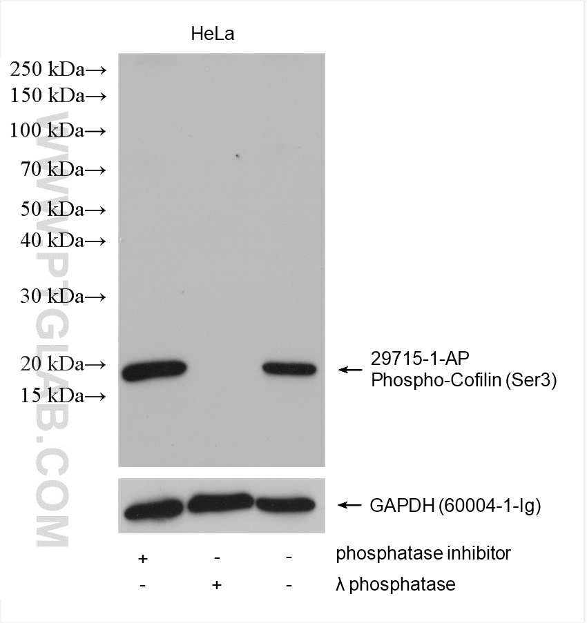 Phospho-Cofilin (Ser3)