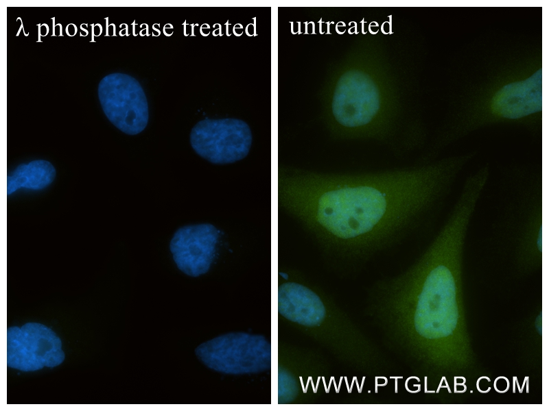 Immunofluorescent analysis of (4% PFA) fixed λ phosphatase treated Hela cells using Phospho-Cofilin (Ser3) antibody (86307-1-RR, Clone: 250986H5 ) at dilution of 1:400 and CoraLite®488-Conjugated Goat Anti-Rabbit IgG(H+L) (<a class='green' href='/productredirect?CatalogNo=SA00013-2' target='_blank'>SA00013-2</a>). IF Staining of Hela using 86307-1-RR