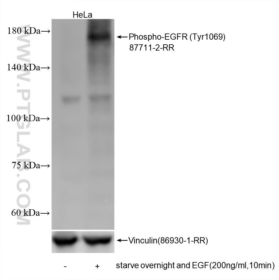 WB analysis using 87711-2-RR (same clone as 87711-2-PBS) WB analysis using 87711-2-RR (same clone as 87711-2-PBS)